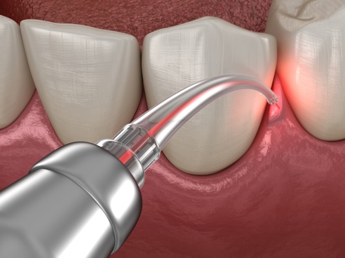 Cirugia Oral en Emeryville, CA | Dr. Rose Magno