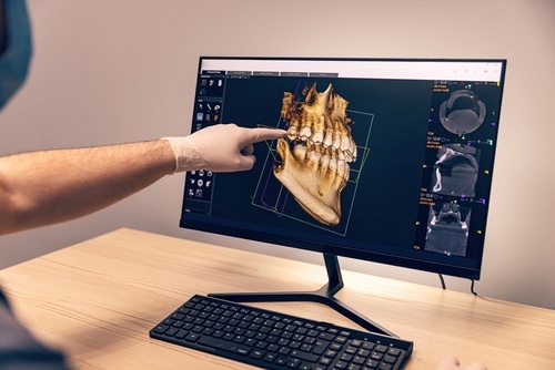 Digital X-rays in Emeryville, CA | Dr. Rose Magno