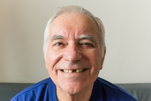 Implantes Dentales Mono en Emeryville, CA | Soluciones para la Pérdida de Dientes