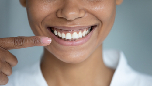 Smile Makeover en Emeryville, CA | Reserve una consulta