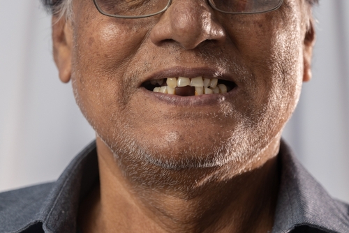 Dientes nuevos en Emeryville, CA | Reserve una consulta | Dr. Magno