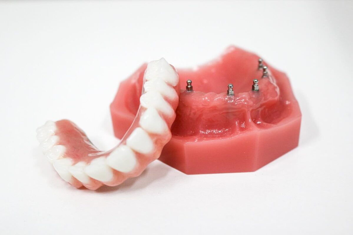 Roundhouse Bridge in Emeryville, CA | Secure Your Smile Today