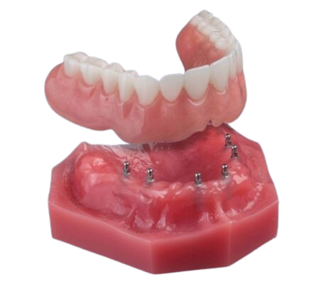Snap-On Dentures in Emeryville, CA | Secure Your Smile Today