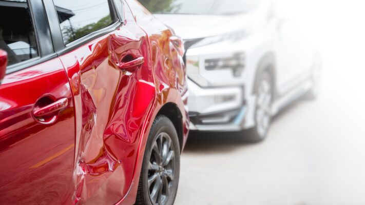 Dentista especializado en accidentes automovilísticos en Emeryville, California | Dentista de urgencias en Lien