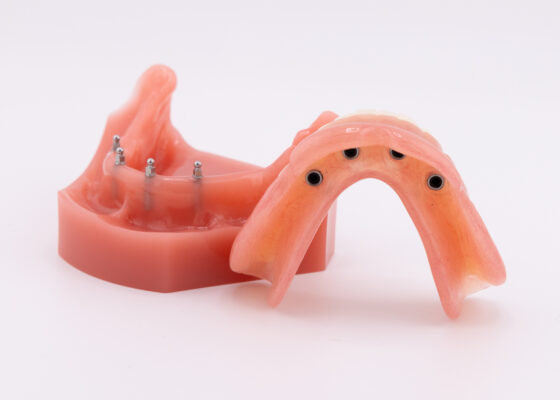 Mini Dentures in Emeryville, CA | Snap-In Denture [Video Guide]