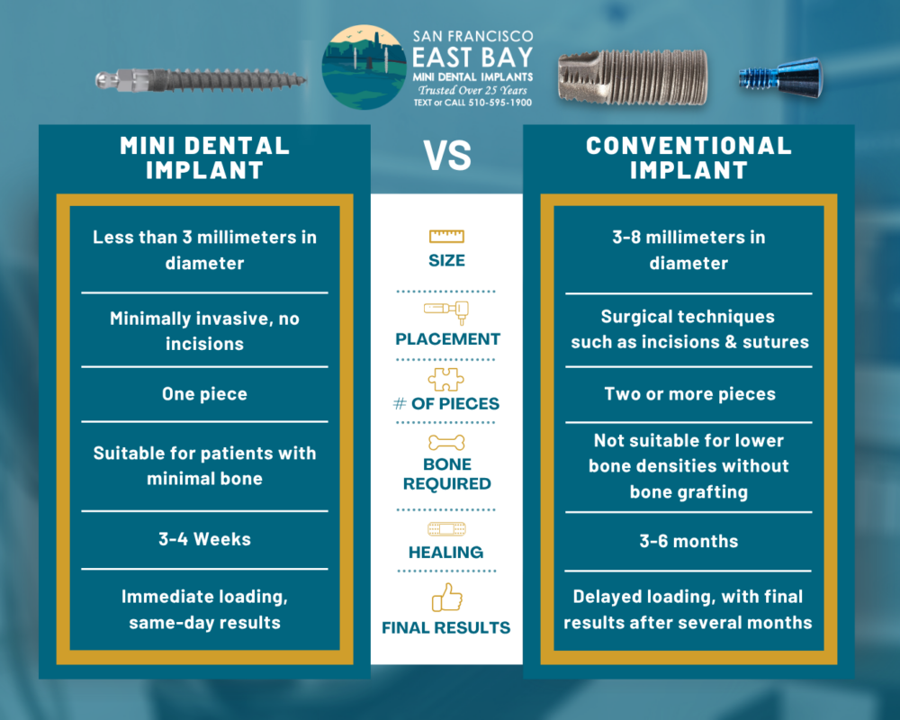 Types of Dental Implants in Emeryville, CA [Video Explainer] 🦷