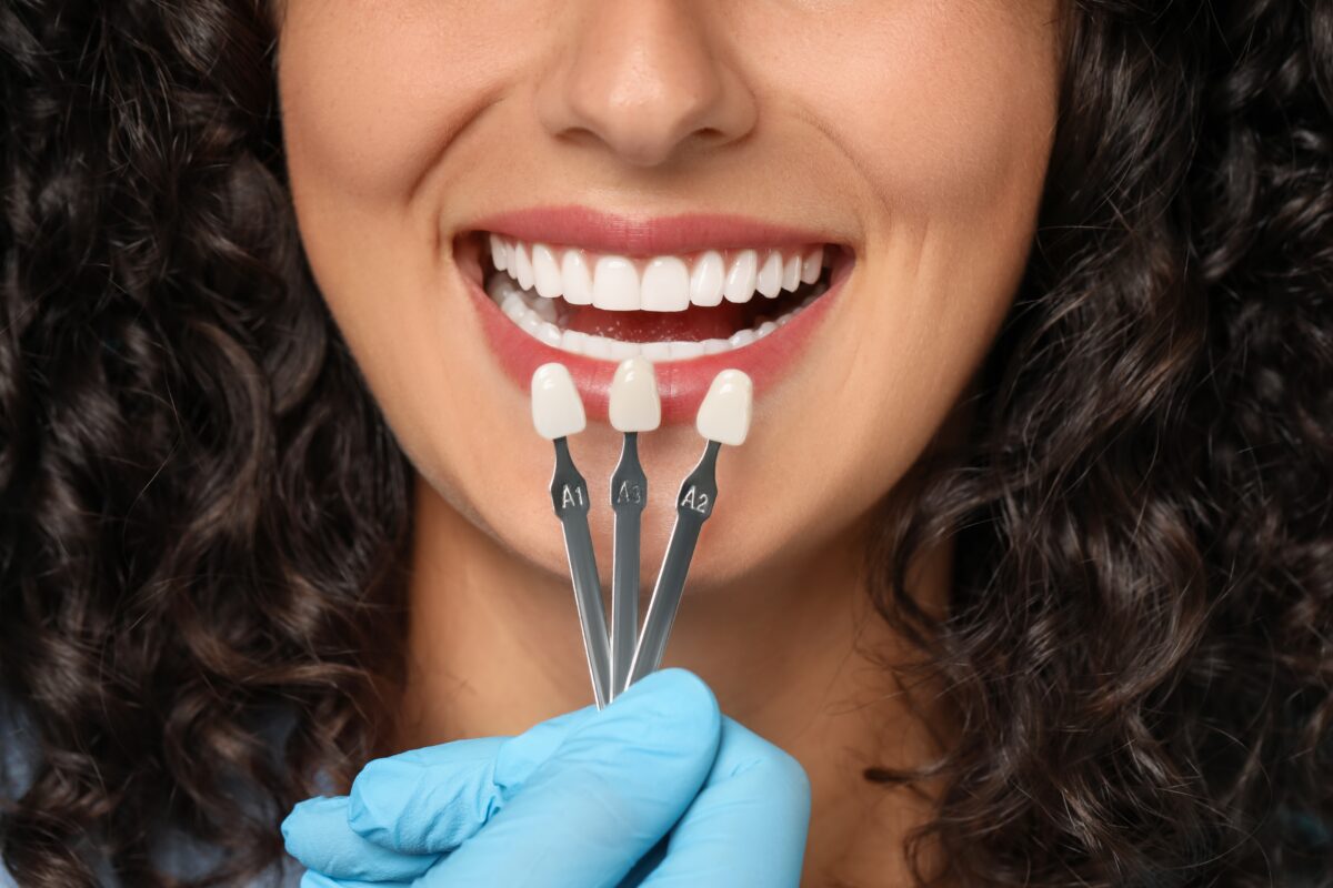 Cosmetic Dentist in Emeryville, CA [Video Explainer]